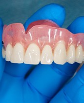 A close-up of a gloved hand holding an upper denture